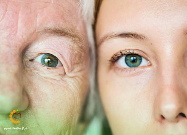 یکی از علت های خشکی چشم افزایش سن است- درمان خشکی چشم در مرکز سلامت نسیم