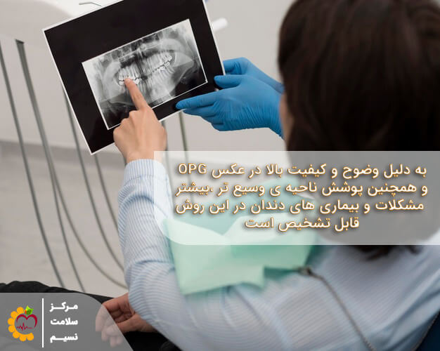 عکس برداری opg دندان برای تشخیص بیماری های دندان