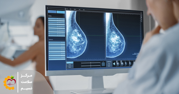 چگونگی تشخیص سرطان سینه با ماموگرافی