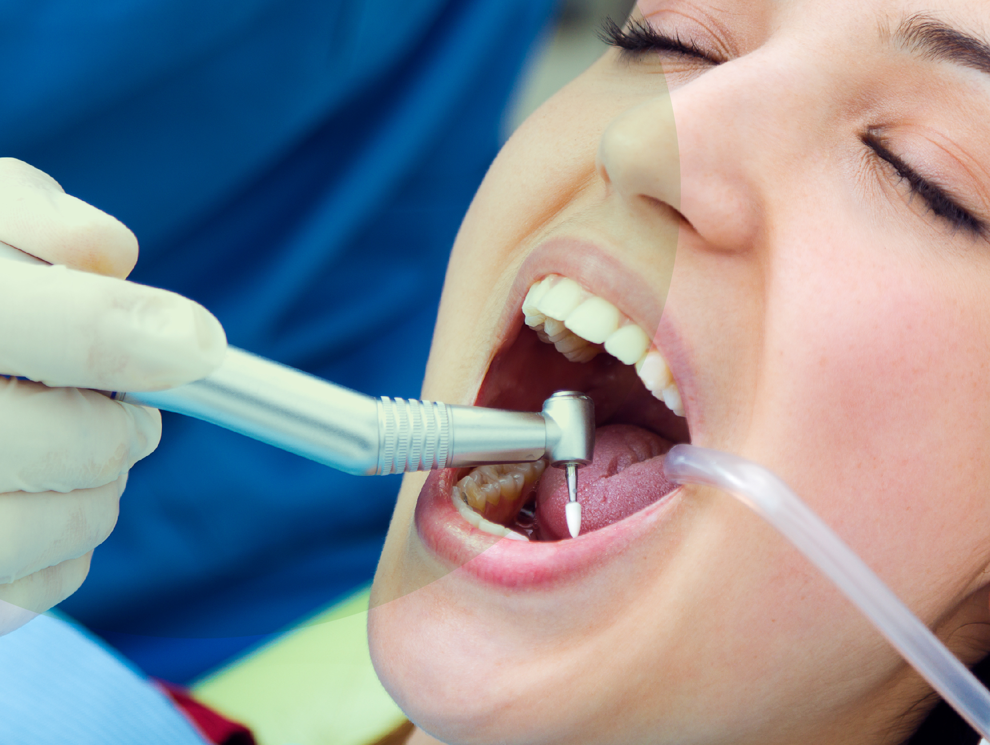 معاینات دندان