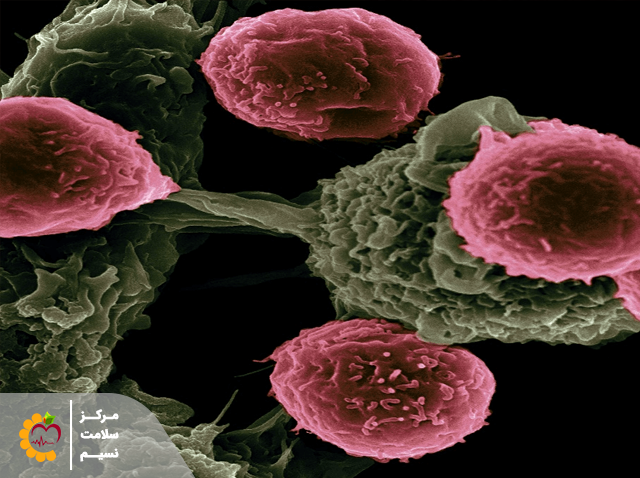 سلول های سرطانی 