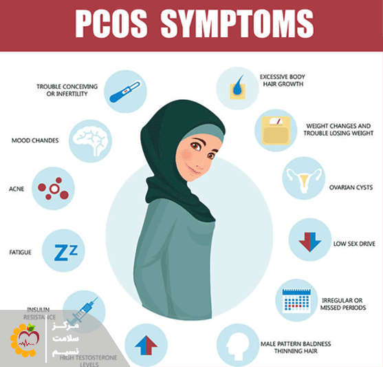علائم و نشانه های سندروم تخمدان پلی کیستیک