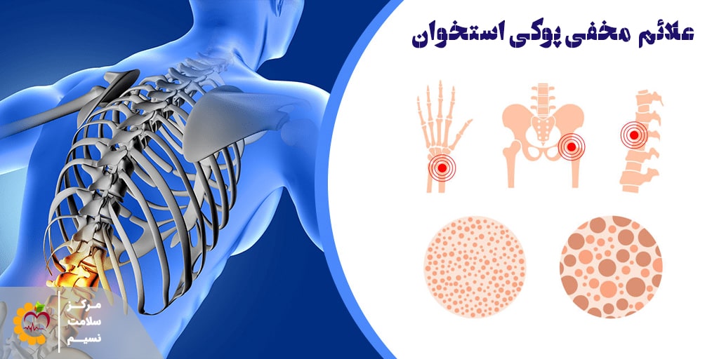 علائم مخفی پوکی استخوان که نمیدانید!!