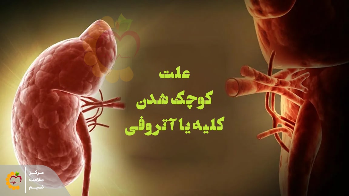 علت کوچک شدن کلیه چیست؟